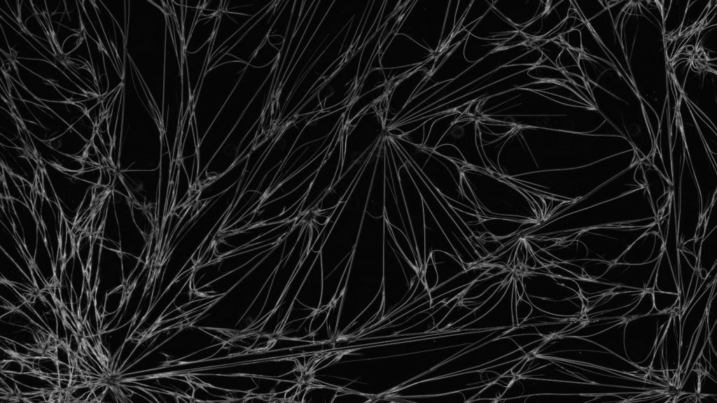 dark field microscopy of caffeine crystals.